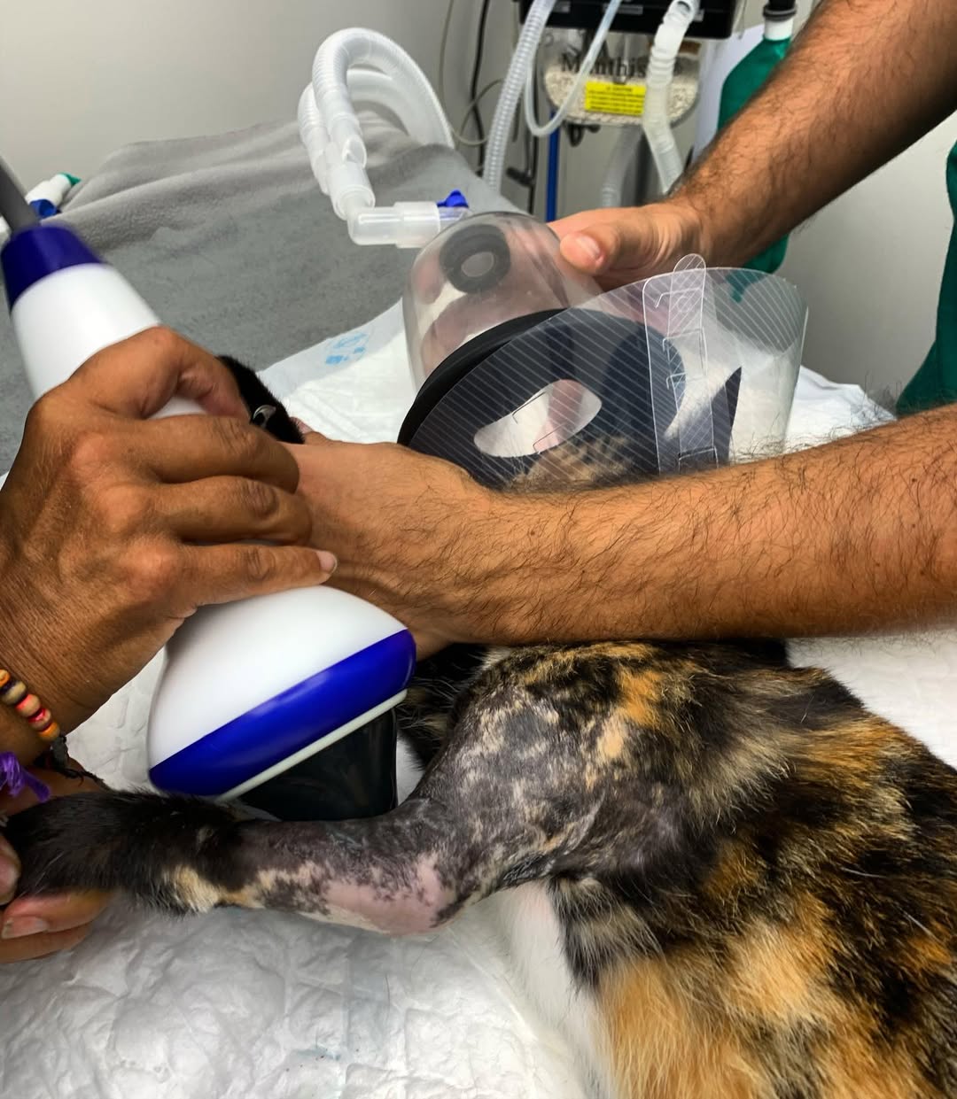 Terapia com Ondas de Choque Extracorporais